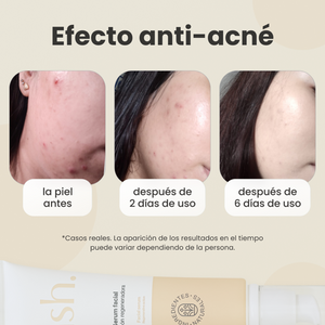 Serum Facial