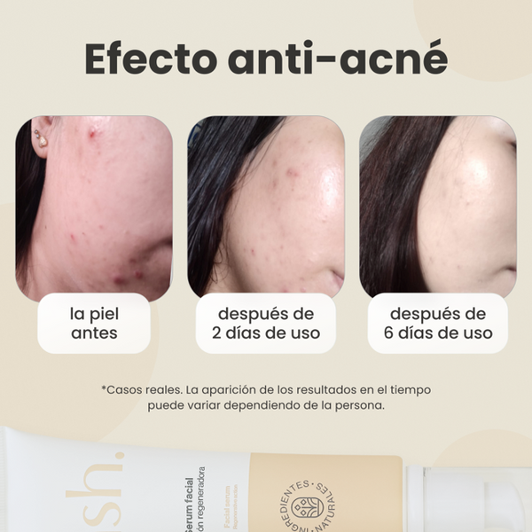Serum Facial